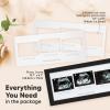 imageKeaBabies Baby Sonogram Picture Frame  Modern Ultrasound Picture Frames for Mom to Be First Pregnancy Gifts for Expecting Mom ampamp First Time Dad Baby Gender Reveal Gifts Petal PinkOnyx Black