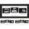 imageKeaBabies Baby Sonogram Picture Frame  Modern Ultrasound Picture Frames for Mom to Be First Pregnancy Gifts for Expecting Mom ampamp First Time Dad Baby Gender Reveal Gifts Petal PinkOnyx Black