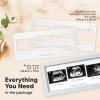 imageKeaBabies Baby Sonogram Picture Frame  Modern Ultrasound Picture Frames for Mom to Be First Pregnancy Gifts for Expecting Mom ampamp First Time Dad Baby Gender Reveal Gifts Petal PinkMist Blue