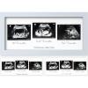 imageKeaBabies Baby Sonogram Picture Frame  Modern Ultrasound Picture Frames for Mom to Be First Pregnancy Gifts for Expecting Mom ampamp First Time Dad Baby Gender Reveal Gifts Petal PinkMist Blue