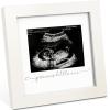 imageKeaBabies Baby Sonogram Picture Frame  Modern Ultrasound Picture Frames for Mom to Be First Pregnancy Gifts for Expecting Mom ampamp First Time Dad Baby Gender Reveal Gifts Petal PinkAlpine White