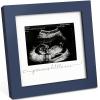 imageKeaBabies Baby Sonogram Picture Frame  Modern Ultrasound Picture Frames for Mom to Be First Pregnancy Gifts for Expecting Mom ampamp First Time Dad Baby Gender Reveal Gifts Petal PinkMidnight Blue