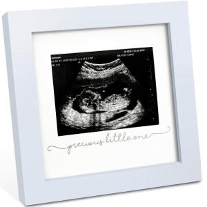 imageKeaBabies Baby Sonogram Picture Frame  Modern Ultrasound Picture Frames for Mom to Be First Pregnancy Gifts for Expecting Mom ampamp First Time Dad Baby Gender Reveal Gifts Petal PinkMist Blue